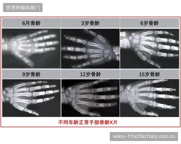 多数俱乐部仍将AI骨龄预测作为“打假工具”，未能发挥其在个性化训练和营养干预上的深层价值